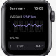 Apple Watch Nike SE GPS 44mm Space Grey Aluminium Case with Anthracite/Black Nike Sport Band (MKQ83) 